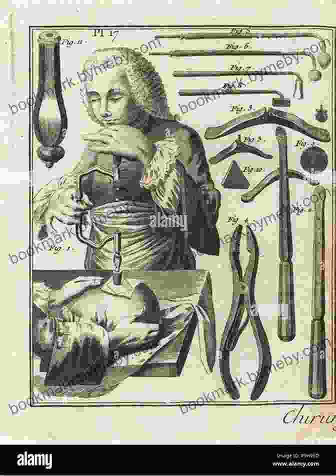 Surgeon Performing Trepanning On A Patient In Early America Bleed Blister Puke And Purge: The Dirty Secrets Behind Early American Medicine