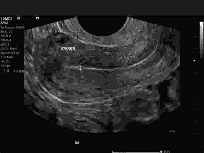 Ultrasound Imaging Can Assess The Size And Shape Of The Uterus, Ovaries, And Fallopian Tubes. Female Infertility What You Should Know